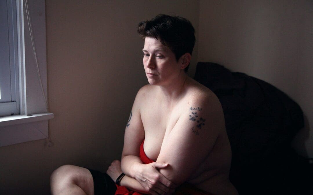 Are There Natural Ways to Manage PCOS?